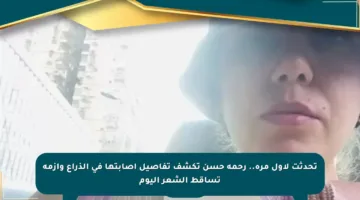 تحدثت لأول مرة.. رحمة حسن تكشف تفاصيل إصابتها في الذراع وأزمة تساقط الشعر اليوم
